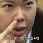 ■記事２■　ペク・ジヨン「整形10億ウォン説」の裏側…鼻の副作用に医師も慎重姿勢
